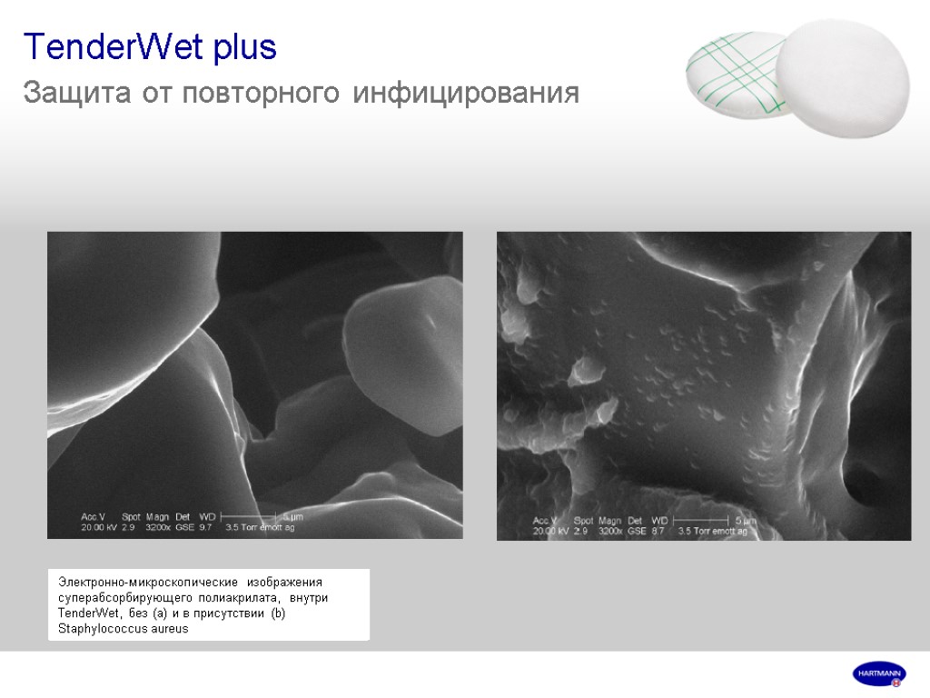 TenderWet plus Защита от повторного инфицирования Электронно-микроскопические изображения суперабсорбирующего полиакрилата, внутри TenderWet, без (а)